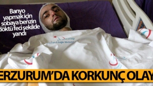 Banyo yapmak için sobaya benzin döktü, feci şekilde yandı