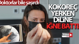 Kokoreç yerken diline iğne batan kadın doktorları da şaşırttı 