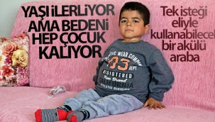 Yaşı ilerliyor ama bedeni hep çocuk kalıyor