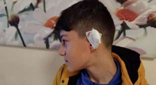 Başıboş köpek kartopu oynayan gence saldırdı