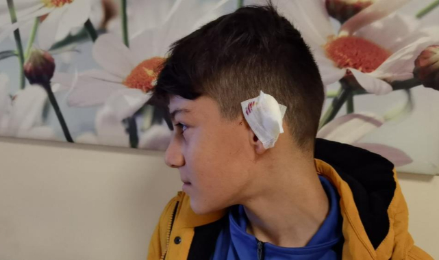 Başıboş köpek kartopu oynayan gence saldırdı