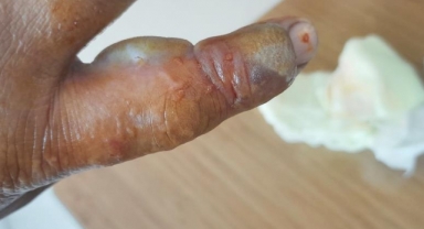 Elini sokan yılanla hastaneye koştu