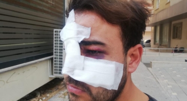 Hatay'da istek şarkıyı bilmeyen müzisyenin yüzünde şişe kırdılar