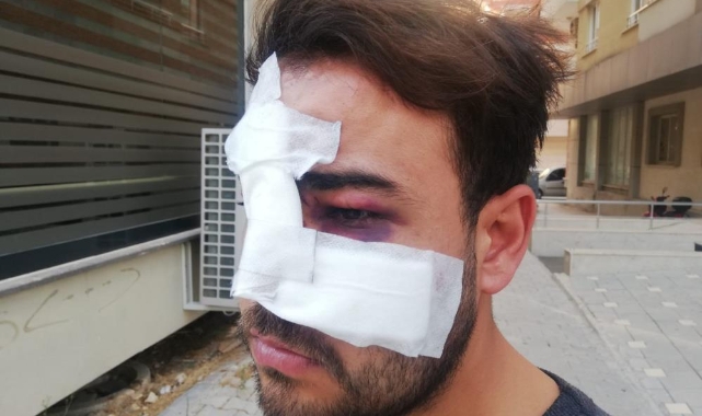 Hatay'da istek şarkıyı bilmeyen müzisyenin yüzünde şişe kırdılar