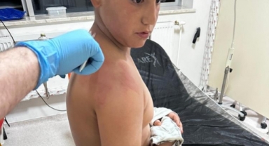 10 yaşındaki çocuğu kaynar çayla haşladı