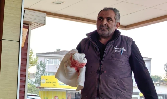 Kesim makinesi, 4 parmağını parçaladı
