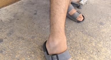 Duş alırken akrep soktu