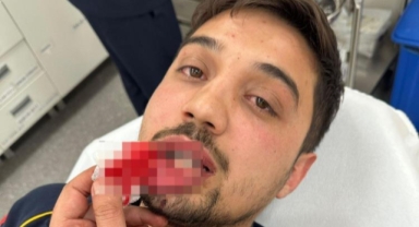 Bursa'da ambulans şoförü darp edildi