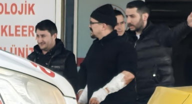 Köpek, mobilya işçisinin kollarını parçaladı