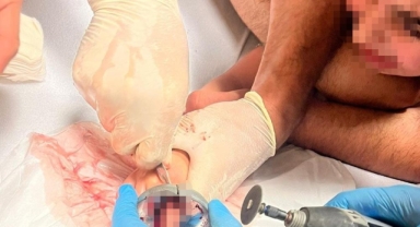 İnegöl'de çocuğun parmağı çeşme aynasına sıkıştı