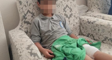 Okula giderken sokak köpeğinin saldırısına uğradı