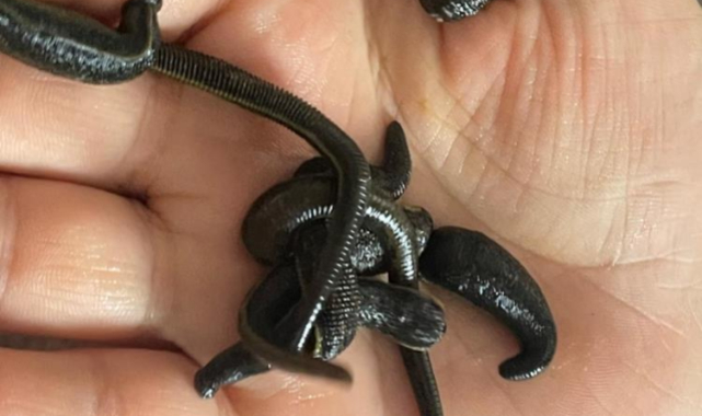 Kadınlar cilt güzelliğini sülükte arıyor